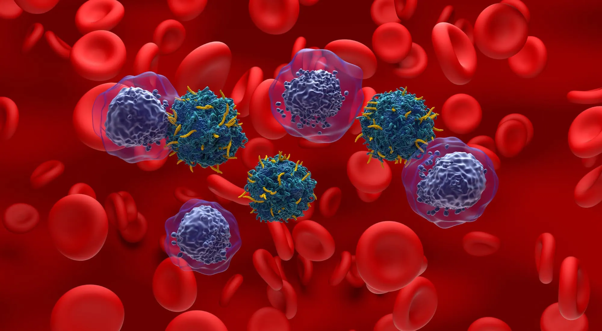 Nemes-Laszlo_iStock-2175600990_2000x1098 CAR-T-Zelltherapie bei akuter myeloischer Leukämie (AML)